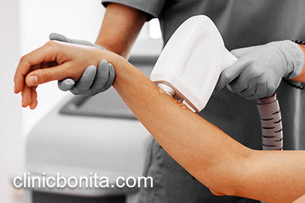 هزینه لیزر موهای زائد | کلینیک بنیتای اصفهان