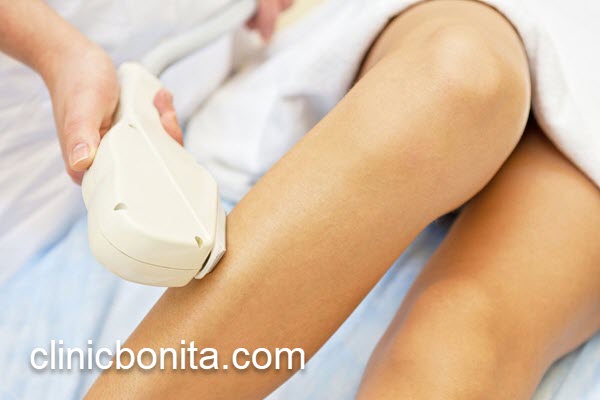 آشنایی با قیمت لیزر موهای زائد | کلینیک بنیتای اصفهان