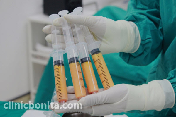 مراحل تزریق چربی چست؟