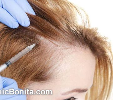 بهترین مرکز پی آر پی مو (PRP) در اصفهان | کلینیک بنیتا