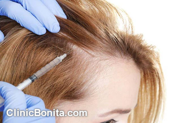 بهترین مرکز پی آر پی مو (PRP) در اصفهان | کلینیک بنیتا