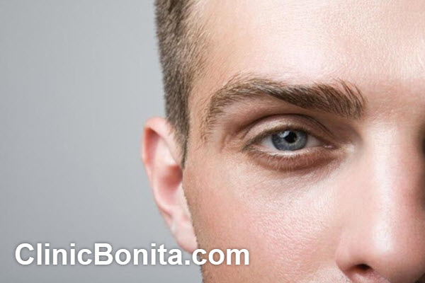 آیا سیخ شدن ابرو بعد از کاشت طبیعی است؟ | کلینیک بنیتای اصفهان