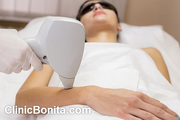 آشنایی با مراقبت های بعد از لیزر موهای زائد | کلینیک بنیتای اصفهان