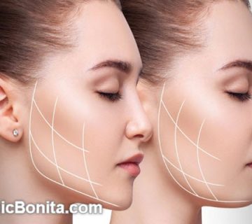 هزینه عمل بوکال فت صورت چقدر است؟ | کلینیک بنیتای اصفهان