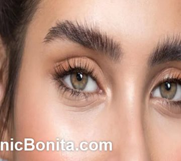 علت سیخ شدن ابرو بعد از کاشت | کلینیک بنیتای اصفهان