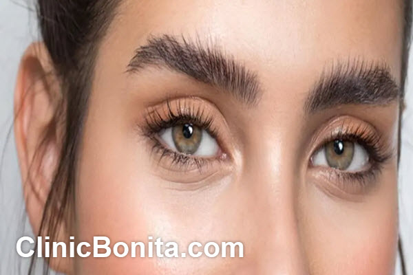 علت سیخ شدن ابرو بعد از کاشت | کلینیک بنیتای اصفهان