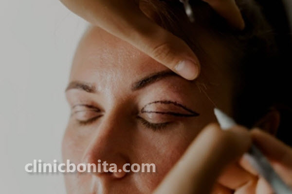 علت کوچک شدن چشم بعد از عمل بلفاروپلاستی