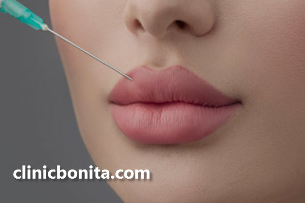 مراقبت های بعد از تزریق ژل لب