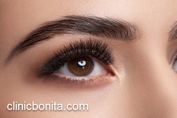 کاندیدای نامناسب کاشت مو چه کسانی هستند؟