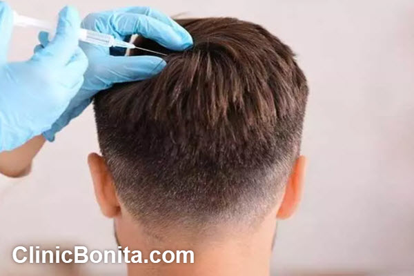 چرا کلینیک بنیتا بهترین و بزرگترین مرکز کاشت مو در اصفهان است؟ | کلینیک بنیتا