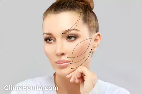 لیفت صورت با نخ چقدر دوام دارد؟ | کلینیک بنیتای اصفهان