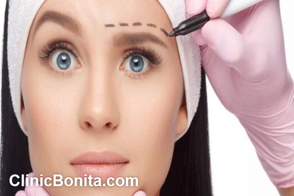 ماندگاری لیفت ابرو با نخ | کلینیک بنیتای اصفهان