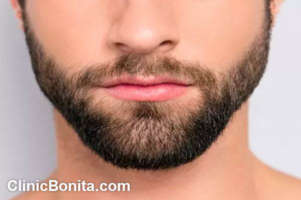 چه عواملی منجر به ماندگاری مو کاشته شده می شود؟ | کلینیک بنیتای اصفهان