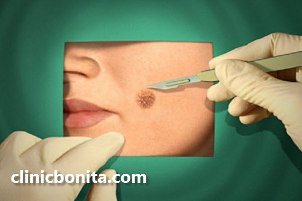 جراحی تومور های پوستی