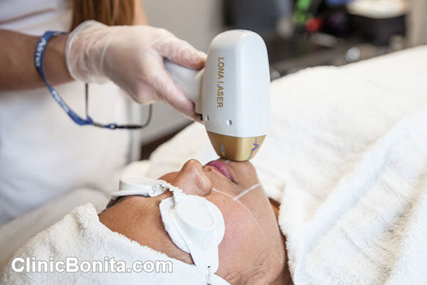 عوامل موثر بر هزینه لیزر موهای زائد | کلینیک بنیتای اصفهان