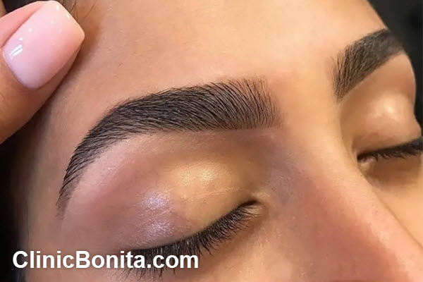 نکات مهم در انتخاب بهترین مرکز کاشت ابرو | کلینیک بنیتای اصفهان