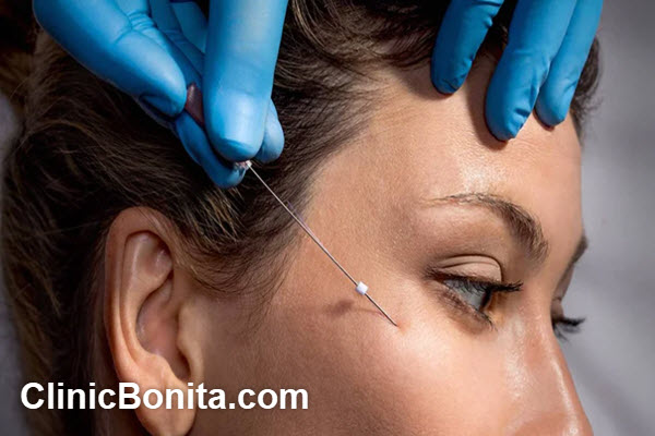 ماندگاری لیفت ابرو با نخ چقدر است؟ | کلینیک بنیتای اصفهان