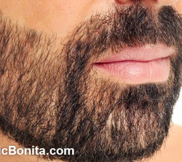 برای کاشت ریش از کجا مو برمیدارن؟ | کلینیک بنیتای اصفهان