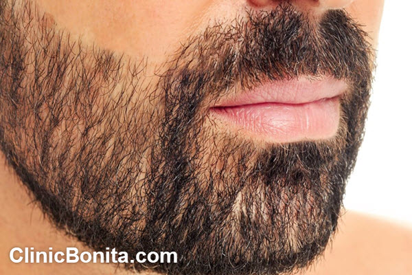 برای کاشت ریش از کجا مو برمیدارن؟ | کلینیک بنیتای اصفهان