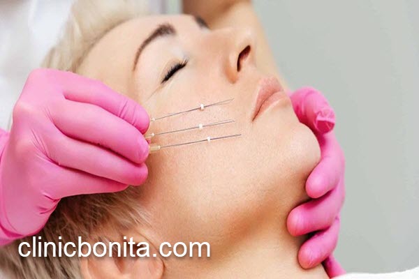 پزشک متخصص لیفت با نخ در اصفهان | کلینیک بنیتای اصفهان