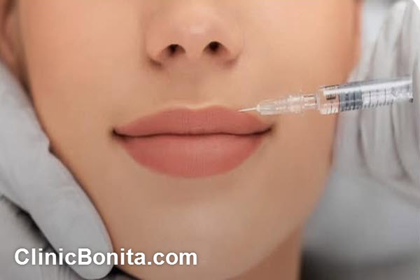 چه افرادی نیاز دارند به بهترین دکتر تزریق ژل لب در اصفهان مراجعه کنند؟ | کلینیک بنیتای اصفهان