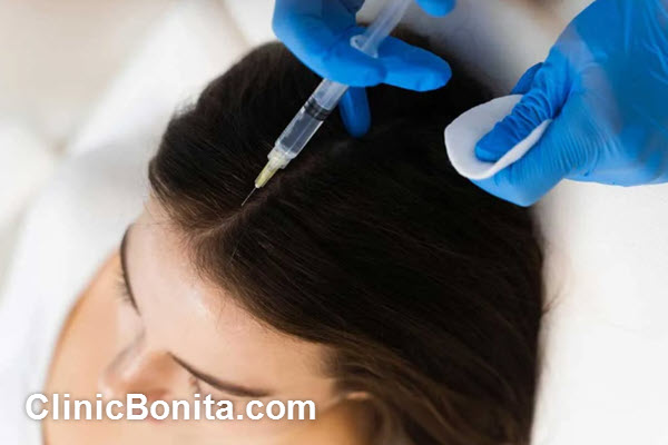 تفاوت مزوتراپی و prp مو چیست؟ | کلینیک بنیتای اصفهان