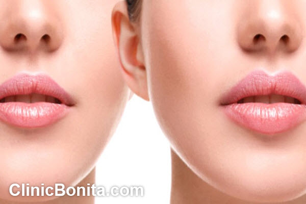 میزان ماندگاری سانترال لب چقدر است؟ | کلینیک بنیتای اصفهان