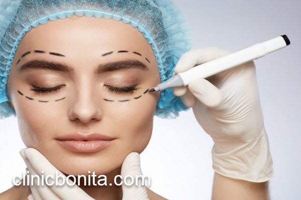 هزینه عمل بلفاروپلاستی پلک در سال 1404 | کلینیک بنیتای اصفهان