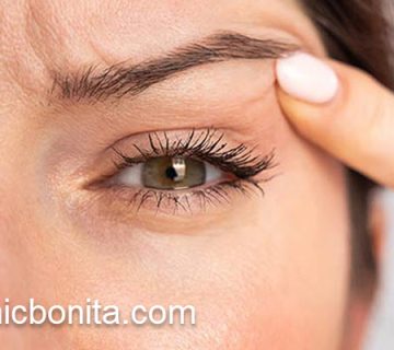 قیمت عمل بلفاروپلاستی در سال 1404 | کلینیک بنیتای اصفهان