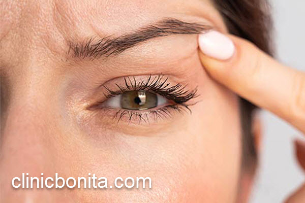 قیمت عمل بلفاروپلاستی در سال 1404 | کلینیک بنیتای اصفهان