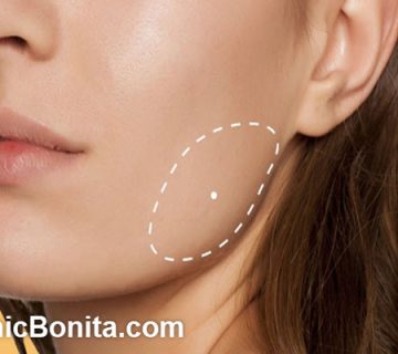 آیا بوکال فت باعث پیری می شود؟ | کلینییک بنیتای اصفهان