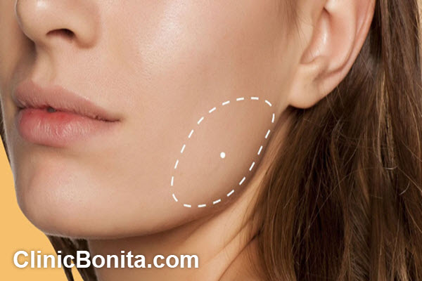 آیا بوکال فت باعث پیری می شود؟ | کلینییک بنیتای اصفهان