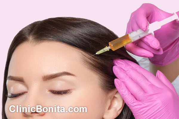 تزریق فیلر مو (Hair Filler) در اصفهان | کلینیک بنیتای اصفهان