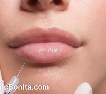 بهترین دکتر برای تزریق فیلر لب در اصفهان | کلینیک بنیتای اصفهان