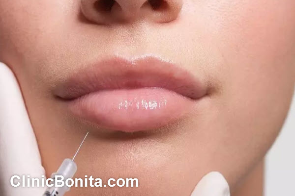 بهترین دکتر برای تزریق فیلر لب در اصفهان | کلینیک بنیتای اصفهان