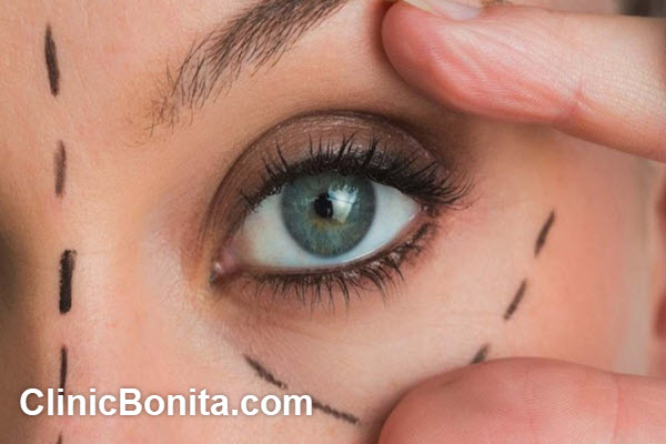 ویژگی های بهترین دکتر لیفت ابرو در اصفهان | کلینیک بنیتا