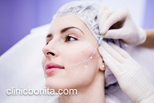 مرکز معتبر لیفت صورت با نخ در اصفهان | کلینیک بنیتای اصفهان