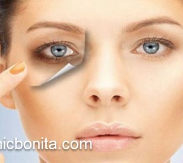 هزینه عمل بلفاروپلاستی پلک با لیزر | کلینیک بنیتای اصفهان