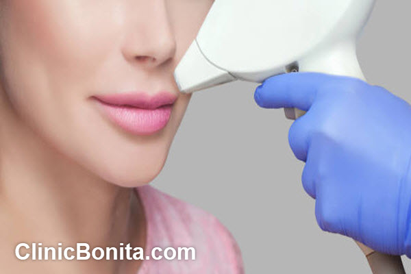 قیمت لیزر صورت زنان چقدر است؟