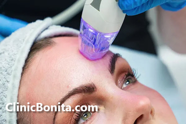 آر اف فرکشنال چیست؟ | اصفهان