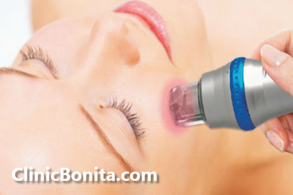 کاندیدای مناسب RF فرکشنال چه کسانی هستند؟