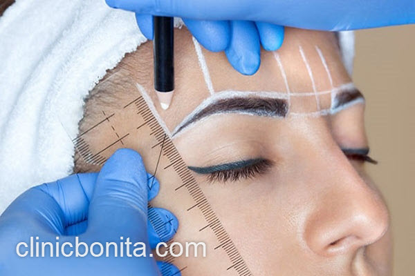 کاشت ابرو نزد پزشکان مجرب | کلینیک بنیتای اصفهان