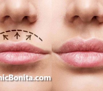 آیا سانترال لب دائمی است؟