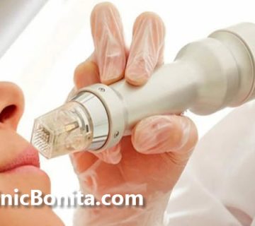 قیمت آر اف فرکشنال صورت چقدر است؟