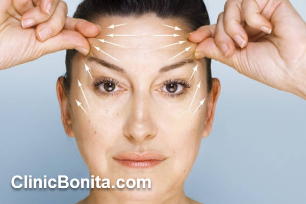 افراد مناسب برای لیفت شقیقه با جراحی