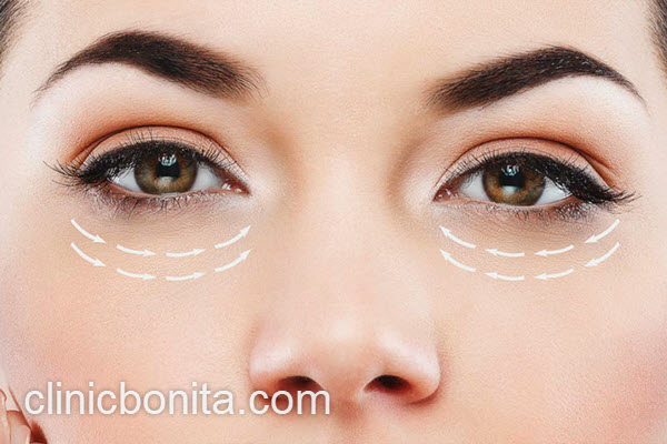 برترین جراح زیبایی چشم | کلینیک بنیتای اصفهان