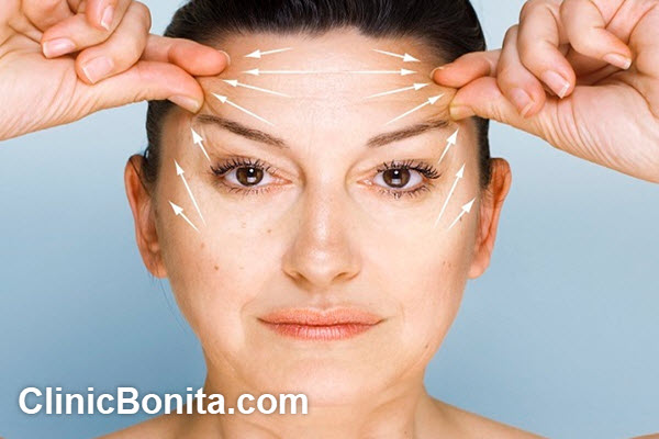 هزینه جراحی لیفت ابرو چقدر است؟