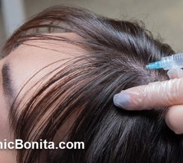 آیا مزوتراپی باعث پرپشتی مو میشود؟