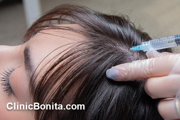 آیا مزوتراپی باعث پرپشتی مو میشود؟