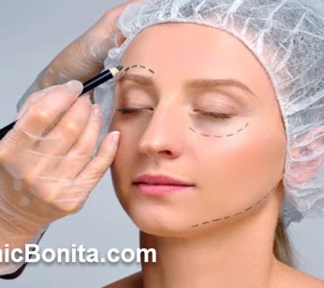 ماندگاری لیفت شقیقه با جراحی چقدر است؟